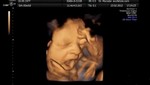 Imágenes increíbles muestran a un bebé bostezando en el útero [VIDEO]