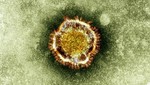 Coronavirus infecta a cuatro más en Arabia Saudita