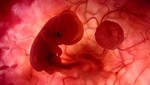 Instan a mantener en secreto el sexo del feto para impedir abortos selectivos en Canadá
