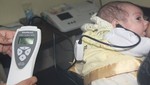 Implementan programa de descarte de sordera en recién nacidos en el hospital 'Dos de Mayo'