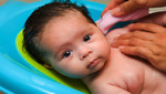 Remedios caseros contra el sarpullido dañan piel de bebés