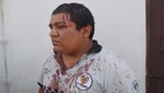 La Victoria: con bate de béisbol, agreden y le rompen la cabeza a policía municipal