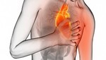 Prevenir un infarto ¡Puede salvarle la vida!