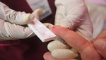 Minsa garantiza el abastecimiento de pruebas rápidas de VIH en Hospital Cayetano Heredia