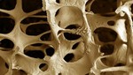 Osteoporosis debe prevenirse desde el embarazo