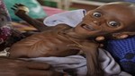 Impactante imagen del bebe símbolo de Africa