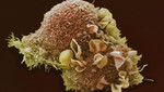 Biólogos afirman haber encontrado la cura del cáncer