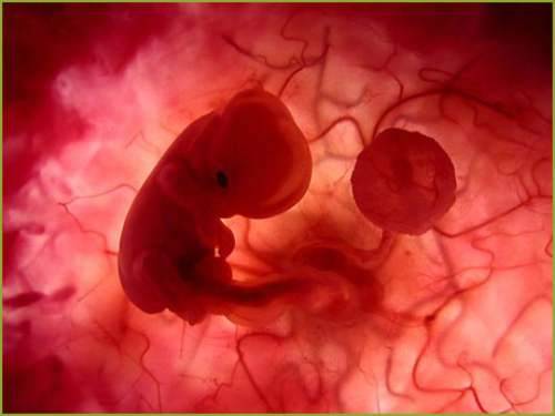 El aborto y la campaña electoral