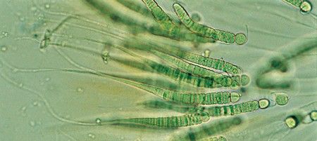 Cianobacterias esenciales en la historia y el futuro del planeta