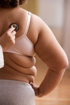 El sobrepeso podría aumentar el riesgo de vivir menos tiempo