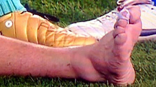 Así quedó el tobillo de Lionel Messi tras su lesión.