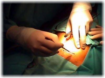 Menos cesáreas Menos cesáreas