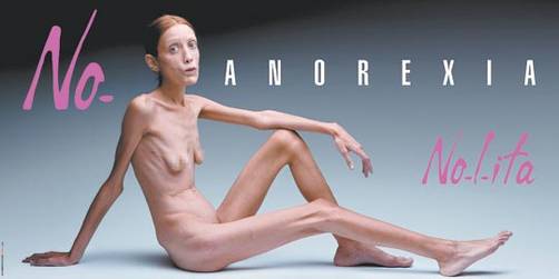 Isabelle Caro modelo anoréxica que posó para polémica campaña publicitaria ha muerto