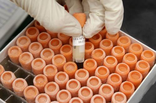 Ciencia y Sociedad: Empiezan a tratar a paciente con células madres embrionarias
