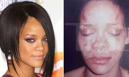 Salen recién las imágenes de Rihanna golpeada