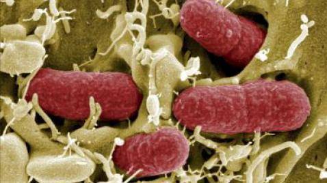 A tomar en cuenta: 'La cepa del 'E.coli alemán' es mutante'