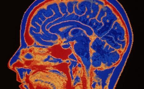 Las dietas favorecen la autofagia: que tu cerebro se coma a sí mismo