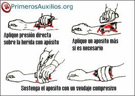 Primeros Auxilios en caso de Hemorragias