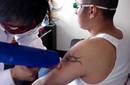 Borrar tatuajes, quitar tatuajes, eliminar tatuaje, tratamiento de tatuajes Perú