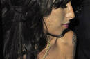 Amy Winehouse tiene una mancha en uno de sus senos
