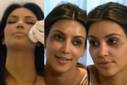 Kim Kardashian luce moretones en el rostro