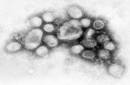 TE INFORMAMOS SOBRE EL VIRUS INFLUENZA AH1N1