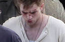 Robert Pattinson tiene moretones y serias heridas en el rostro