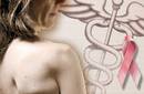La terapia hormonal postmenopausia eleva las muertes por cáncer de mama