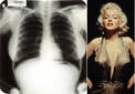Subastan radiografías del pecho de Marilyn Monroe