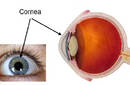 Una córnea artificial para recuperar la visión