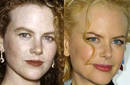 Nicole Kidman adicta a la 'etena juventud estética'