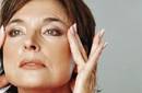 Lifting Facial: Preguntas y respuestas