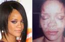 Salen recién las imágenes de Rihanna golpeada