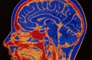Las dietas favorecen la autofagia: que tu cerebro se coma a sí mismo