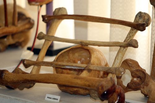 Polémico Museo de Osamentas Humanas del odontólogo Adalberto Meneses está ubicado en Pueblo Libre.