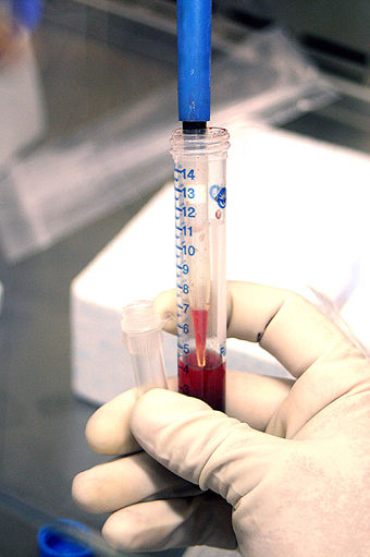 Doctores operando en el hospital Rebagliati
