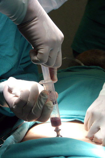 Doctores operando en el hospital Rebagliati