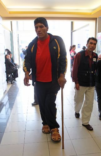 Joven huantino Eliseo Arrieta, afectado por gigantismo