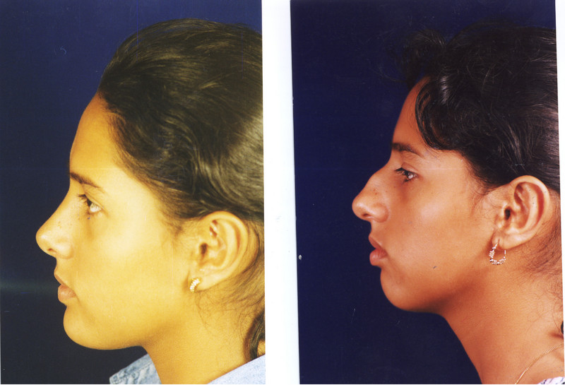 los médicos cirujanos tienen una formación y experiencia muy específicas sobre estética rasgos de la nariz u otras partes del cuerpo